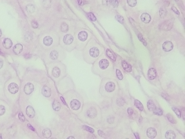 Simple Cuboidal Epithelium Slides - Simple Cuboidal Epithelium 03 400X